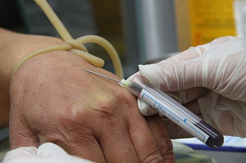 Bệnh globulin miễn dịch kích thích tuyến giáp - triệu chứng, nguyên nhân và cách điều trị