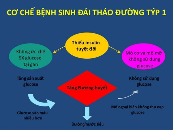 Bệnh đái tháo đường tuýp 1 - triệu chứng, nguyên nhân và cách điều trị