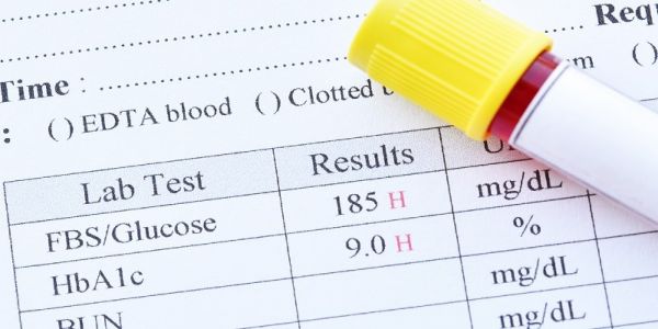 Xét nghiệm kháng thể tự miễn ở bệnh tiểu đường - Những thông tin cần biết