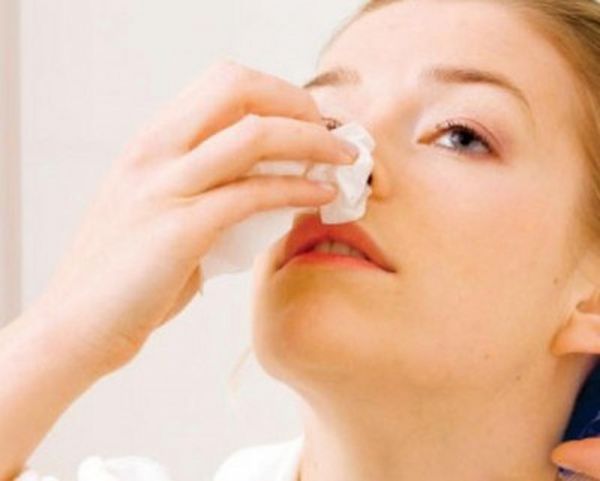 Bệnh chảy máu mũi (chảy máu cam) - triệu chứng, nguyên nhân và cách điều trị