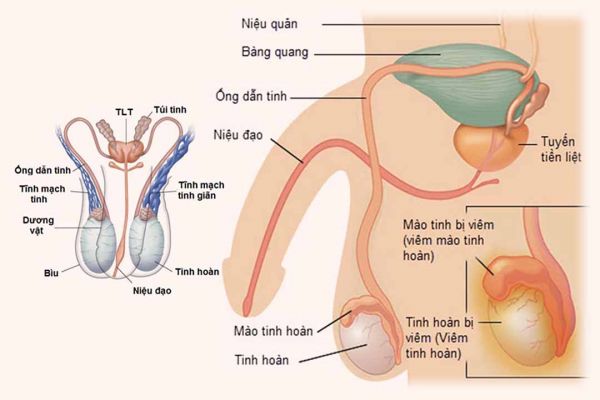 Bệnh tinh hoàn co rút - Triệu chứng, nguyên nhân và cách điều trị