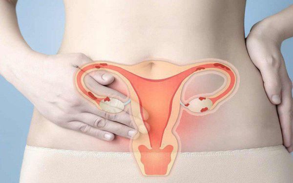 Sinh thiết nội mạc tử cung - Những thông tin cần biết