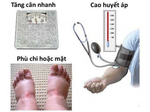 Tiền sản giật: Biến chứng nguy hiểm trong thai kỳ