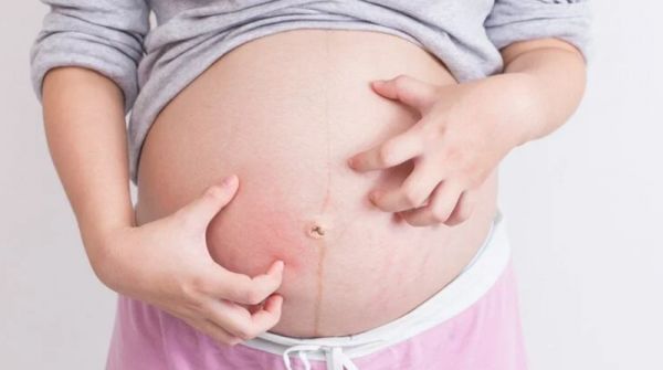 Hội chứng ứ mật thai kỳ - Triệu chứng, nguyên nhân và cách điều trị