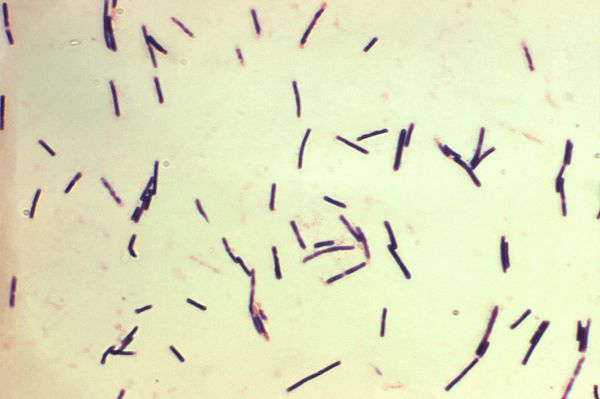 Ngộ độc Clostridium perfringens - Những thông tin cần biết