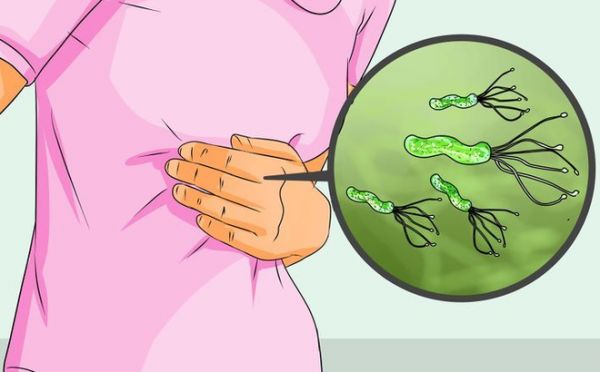 Nhiễm H. pylori - Triệu chứng, nguyên nhân và cách điều trị