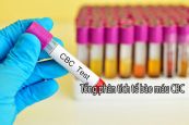 Tổng phân tích tế bào máu CBC - Những thông tin cần biết