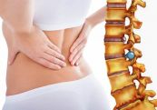Bệnh thoát vị đĩa đệm - Triệu chứng, nguyên nhân và cách điều trị