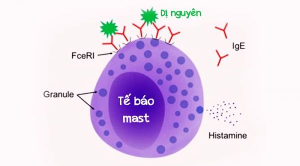 Bệnh tế bào mast hệ thống - Triệu chứng, nguyên nhân và cách điều trị