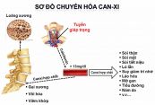 Bệnh tăng canxi máu - Triệu chứng, nguyên nhân và cách điều trị