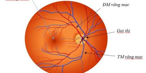 Bệnh tắc động mạch trung tâm võng mạc - Triệu chứng, nguyên nhân và cách điều trị