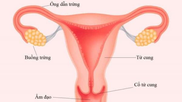 Bệnh tắc ống dẫn trứng - Triệu chứng, nguyên nhân và cách điều trị