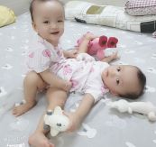 Hội chứng song sinh dính liền - Triệu chứng, nguyên nhân và cách điều trị