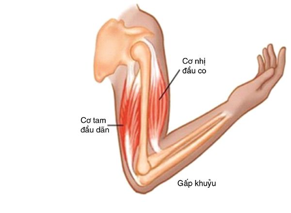 Bệnh rách cơ tam đầu cánh tay - Triệu chứng, nguyên nhân và cách điều trị