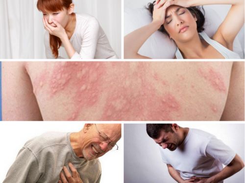 Hội chứng sốc phản vệ - Triệu chứng, nguyên nhân và cách điều trị