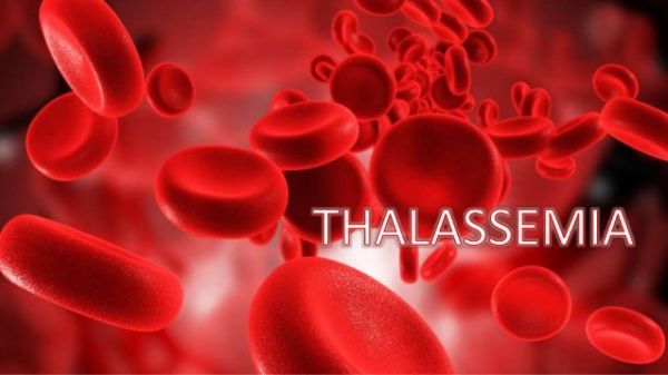 Hội chứng Thalassemia - Triệu chứng, nguyên nhân và cách điều trị