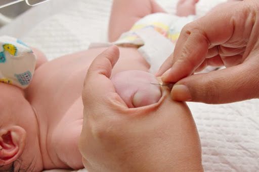 Bệnh thiếu axit ceramidase - Triệu chứng, nguyên nhân và cách điều trị