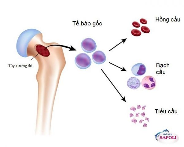 Bệnh thiếu máu bất sản - Triệu chứng, nguyên nhân và cách điều trị