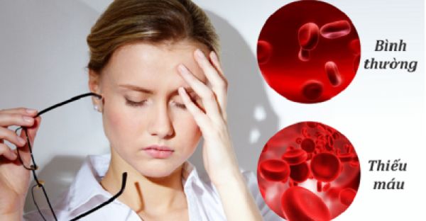 Bệnh thiếu máu do thiếu folate - Triệu chứng, nguyên nhân và cách điều trị