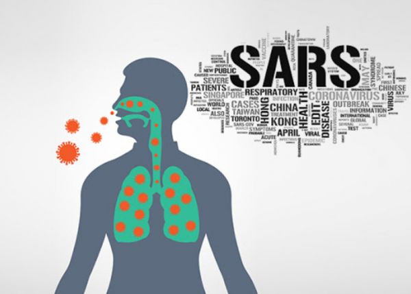 Bệnh SARS (hội chứng suy hô hấp cấp nặng) - Triệu chứng, nguyên nhân và cách điều trị