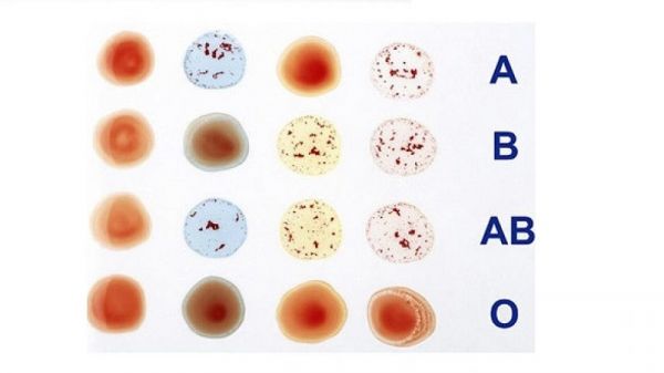 Xét nghiệm nhóm máu - Quy trình thực hiện và những lưu ý cần biết