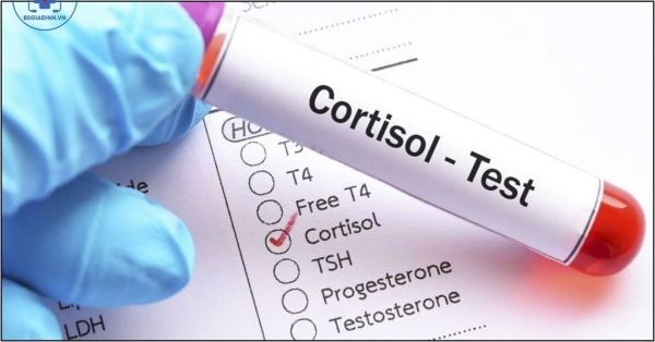 Xét nghiệm nồng độ cortisol - Quy trình thực hiện và những lưu ý cần biết
