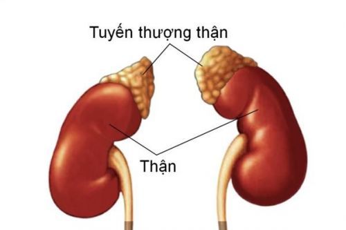 Bệnh u tuyến thượng thận - Triệu chứng, nguyên nhân và cách điều trị