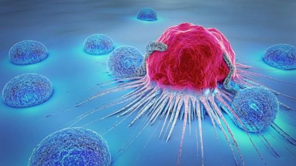 Bệnh ung thư - Triệu chứng, nguyên nhân và cách điều trị