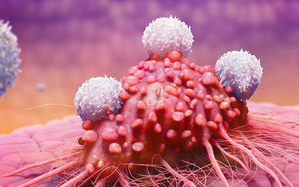 Bệnh tiền ung thư - Triệu chứng, nguyên nhân và cách điều trị