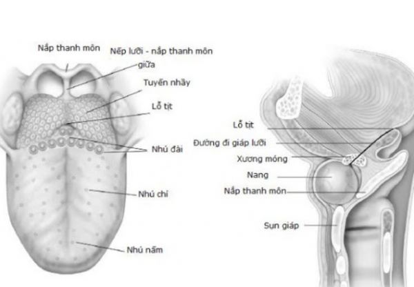 Bệnh nang giáp lưỡi - Triệu chứng, nguyên nhân và cách điều trị