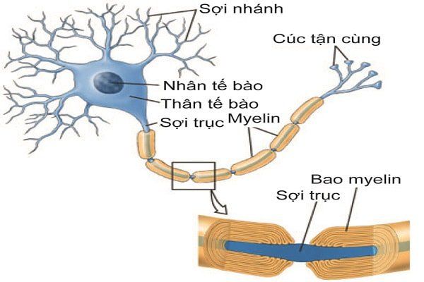 Bệnh viêm đa dây thần kinh hủy myelin mạn tính - Triệu chứng, nguyên nhân và cách điều trị