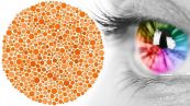 Hội chứng mù màu - Triệu chứng, nguyên nhân và cách điều trị