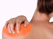 Bệnh viêm gân vai vôi hóa - Triệu chứng, nguyên nhân và cách điều trị