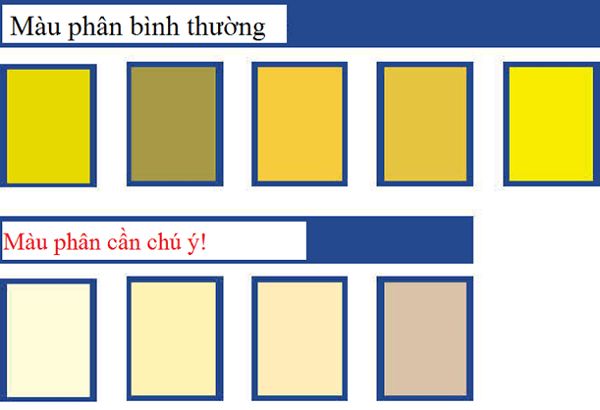 Phân nhạt màu - Triệu chứng, nguyên nhân và cách điều trị