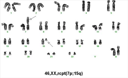 Phân tích nhiễm sắc thể - Quy trình thực hiện và những lưu ý cần biết