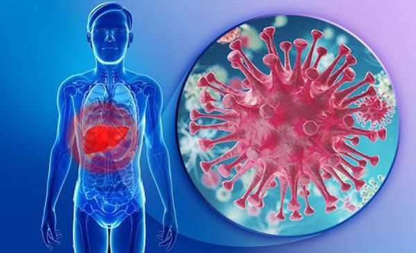 Bệnh viêm gan do virus - Triệu chứng, nguyên nhân và cách điều trị