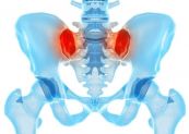 Bệnh viêm khớp cùng chậu - Triệu chứng, nguyên nhân và cách điều trị