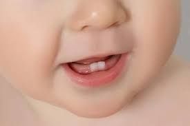 Mọc răng - Triệu chứng, nguyên nhân và cách điều trị