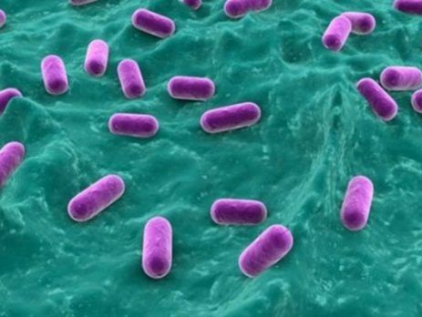 Hội chứng nhiễm vi khuẩn Vibrio parahaemolyticus - Triệu chứng, nguyên nhân và cách điều trị