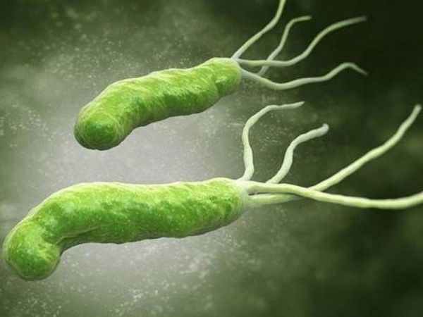 Trực khuẩn mủ xanh - Triệu chứng, nguyên nhân và cách điều trị