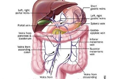 Bệnh viêm hạch mạc treo - Triệu chứng, nguyên nhân và cách điều trị