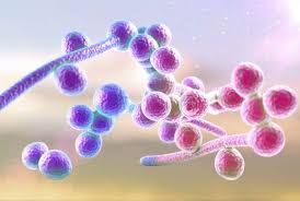 Bệnh nhiễm nấm Histoplasma - Triệu chứng, nguyên nhân và cách điều trị