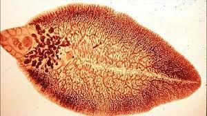 Bệnh nhiễm sán lá gan - Triệu chứng, nguyên nhân và cách điều trị