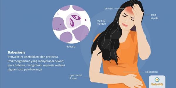 Babesia - Triệu chứng, nguyên nhân và cách điều trị