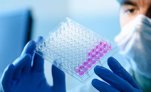 Xét nghiệm xác định HLA - Quy trình thực hiện và những lưu ý cần biết