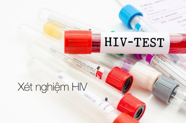 Xét nghiệm số lượng virus HIV - Triệu chứng, nguyên nhân và cách điều trị