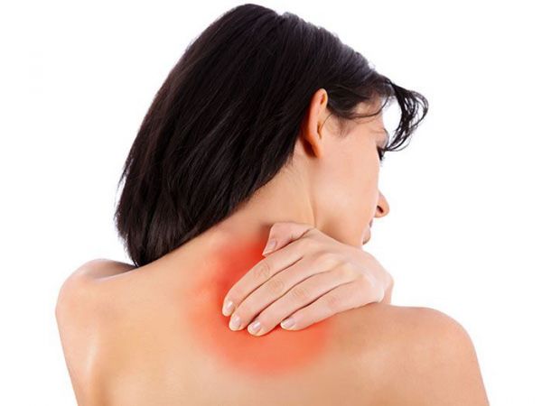 Hội chứng đau cứng cổ - Triệu chứng, nguyên nhân và cách điều trị