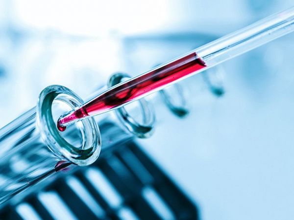 Xét nghiệm kháng thể kháng Glycan - Quy trình thực hiện và những lưu ý cần biết