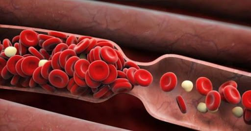 Bệnh máu khó đông - Triệu chứng, nguyên nhân và cách điều trị