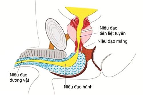 Bệnh viêm niệu đạo không do lậu - Triệu chứng, nguyên nhân và cách điều trị